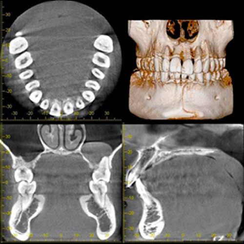 たまプラーザ歯科用CT